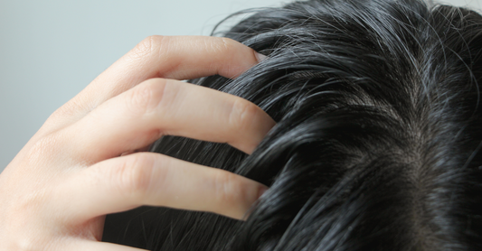 Gérer l'excès de sébum : conseils pour équilibrer votre cuir chevelu